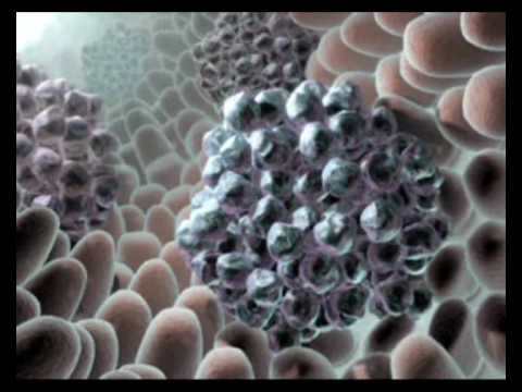 Видео о препарате Гливек таблетки п/о 100мг №120